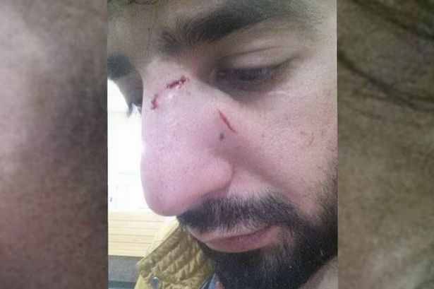 Gang Attacks UK Muslim Nurse Over Beard